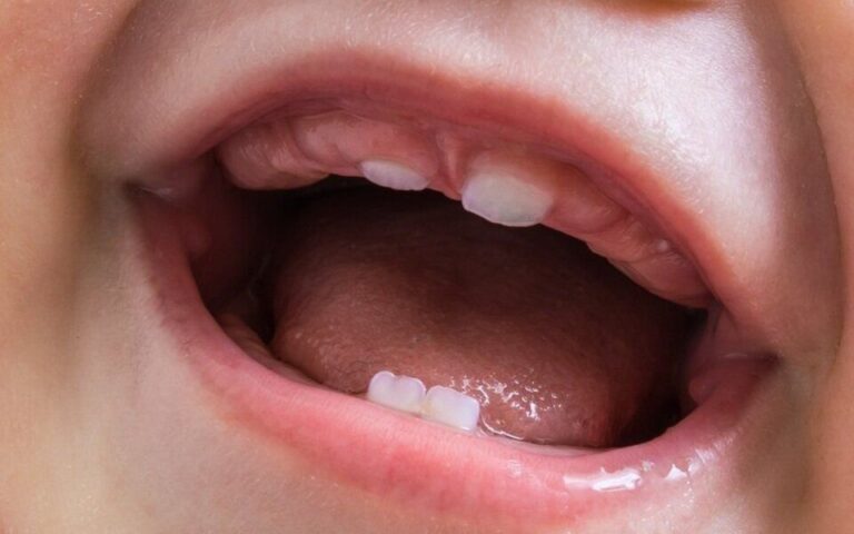 How and When to Brushing Baby’s Teeth