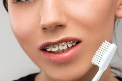 Which Toothbrush is Best for Braces?
