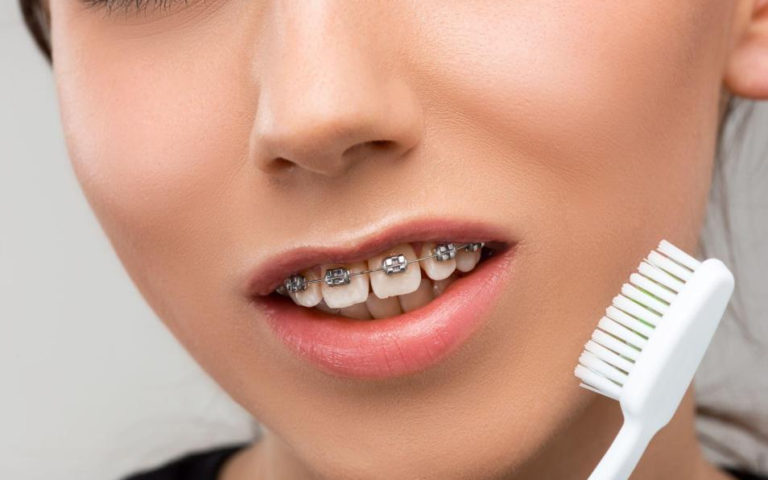 Which Toothbrush is Best for Braces?