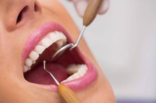How To Stop Tooth Decay? Dentists Recommended!