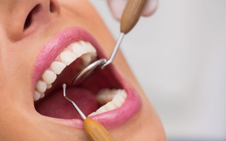 How To Stop Tooth Decay? Dentists Recommended!
