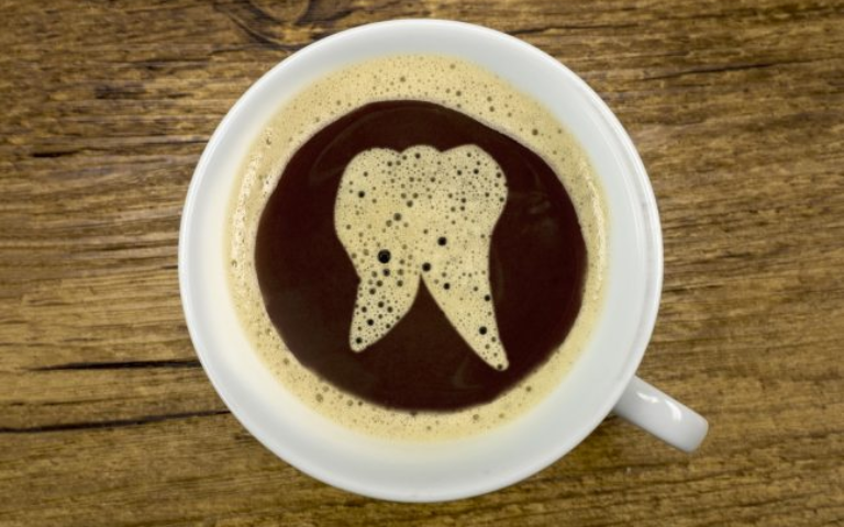 Coffee Stains on Teeth: How to Avoid Them
